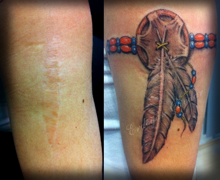 scar-cover-up-tattoos-the-tattoo-ideas-10