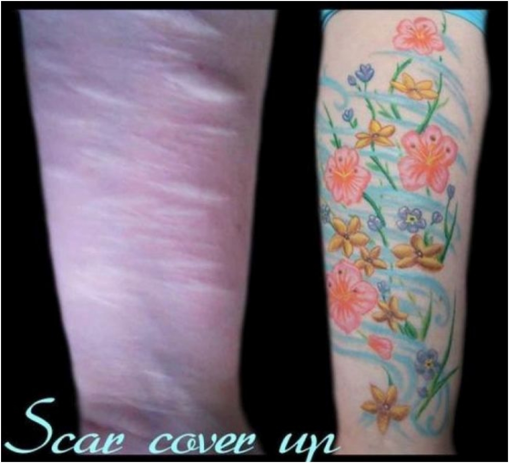 scars_cover_up_07