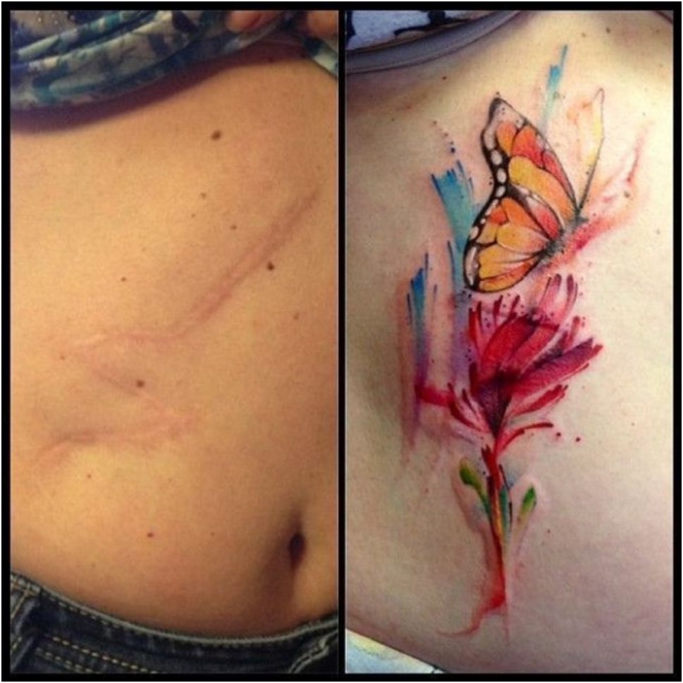 scars_cover_up_10