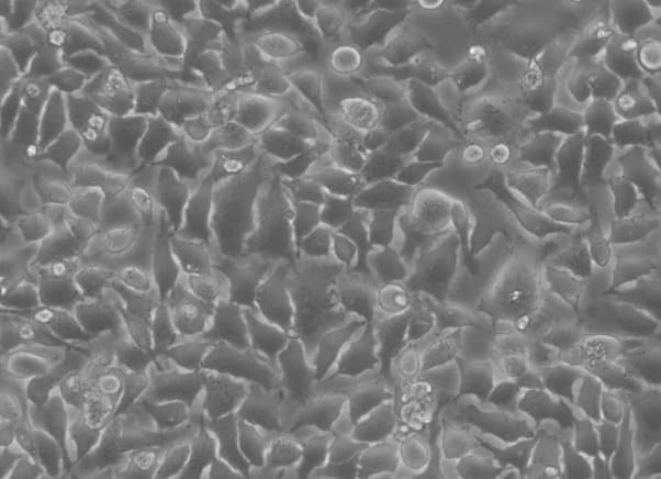 Everything You Should Know About HeLa Cells
