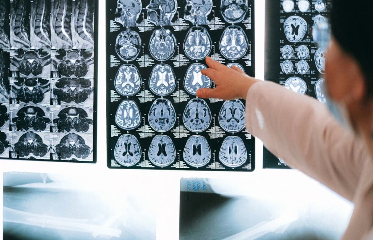 The Role of Brain Injury in Ongoing Physical and Mental Health Challenges