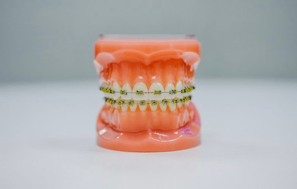 What to Expect When Adjusting to a New Dental Care Routine With Braces