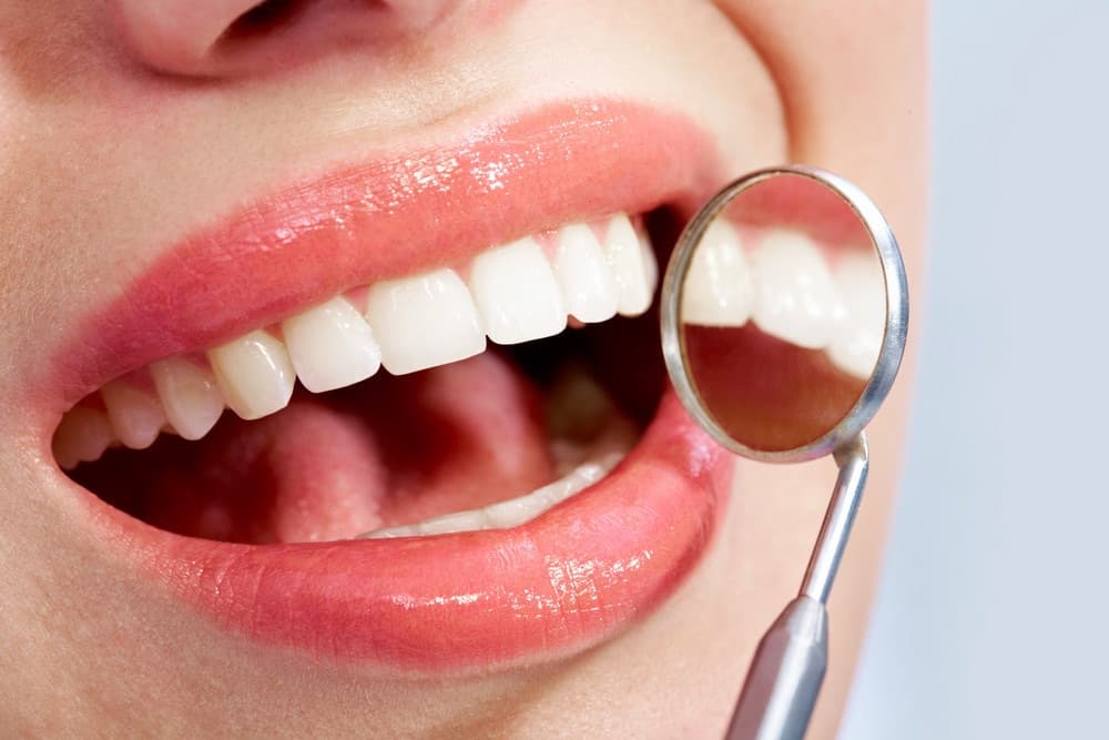 Close-up of a healthy white smile examined with a dental mirror