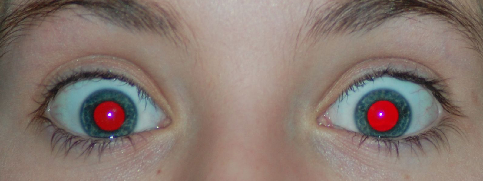 Красные глаза от вспышки. Карие глаза со вспышкой. Цвет глаз со вспышкой. Глаза со вспышкой. Глаза со вспышкой.
