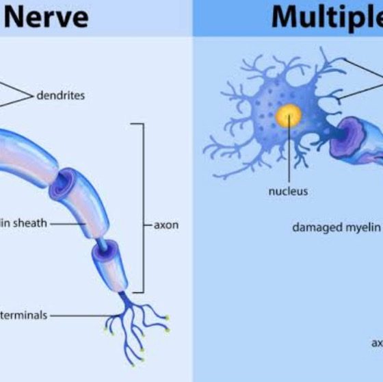 How to fix a rip on a leather sofa