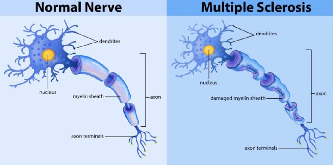 MS FAQs explored and answered