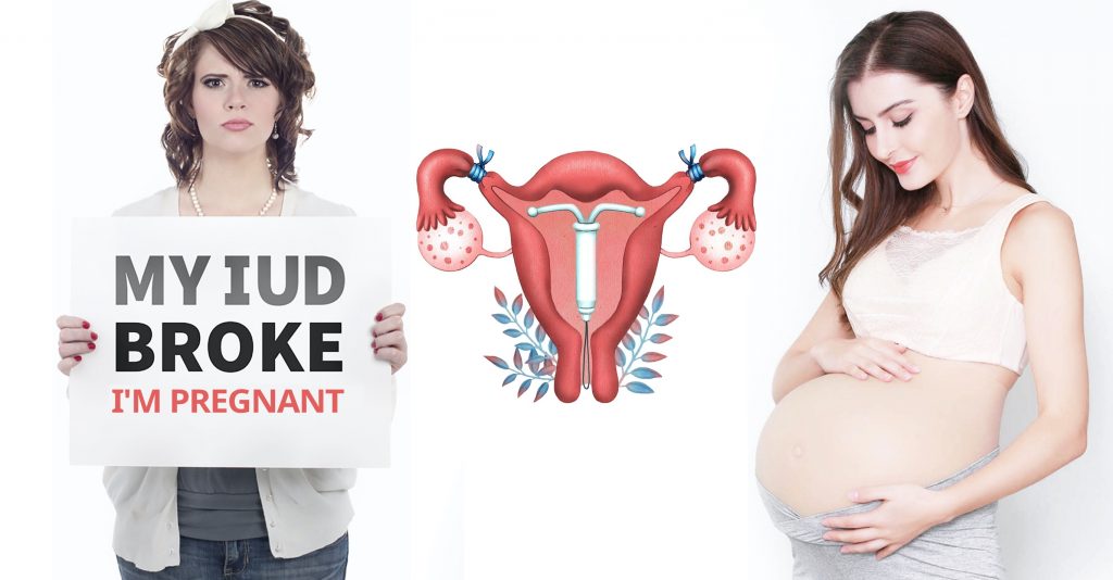 Women Getting Pregnant, IUD Failure” title=”Women Getting Pregnant, IUD Failure