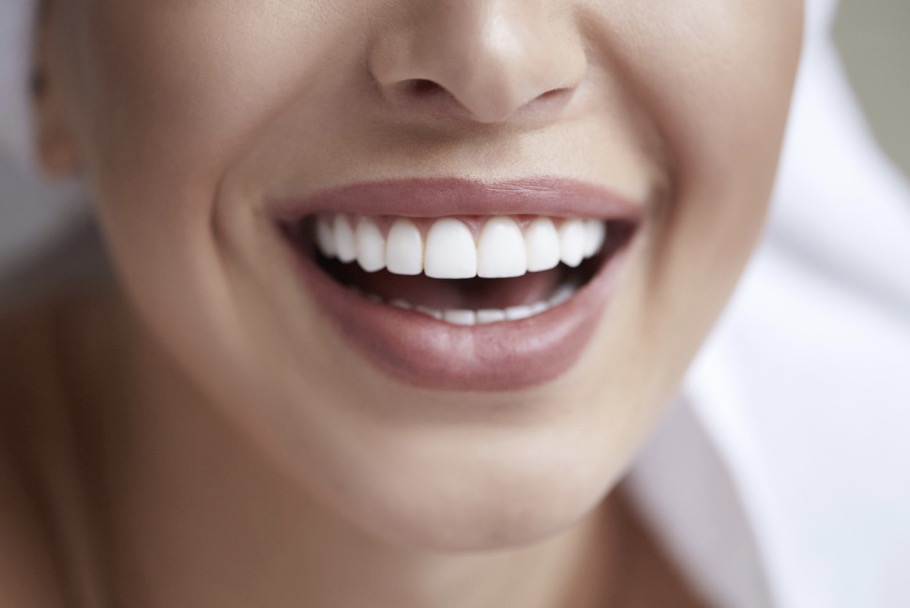 Shiny Teeth! The Different Types of Veneers Explained
