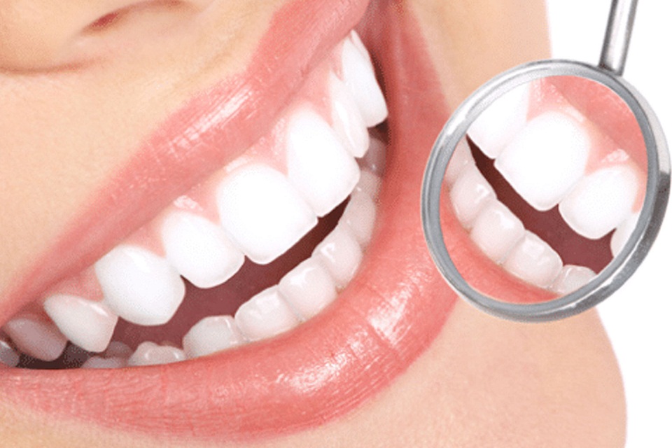 5 Factors to Consider When Choosing a Dentist