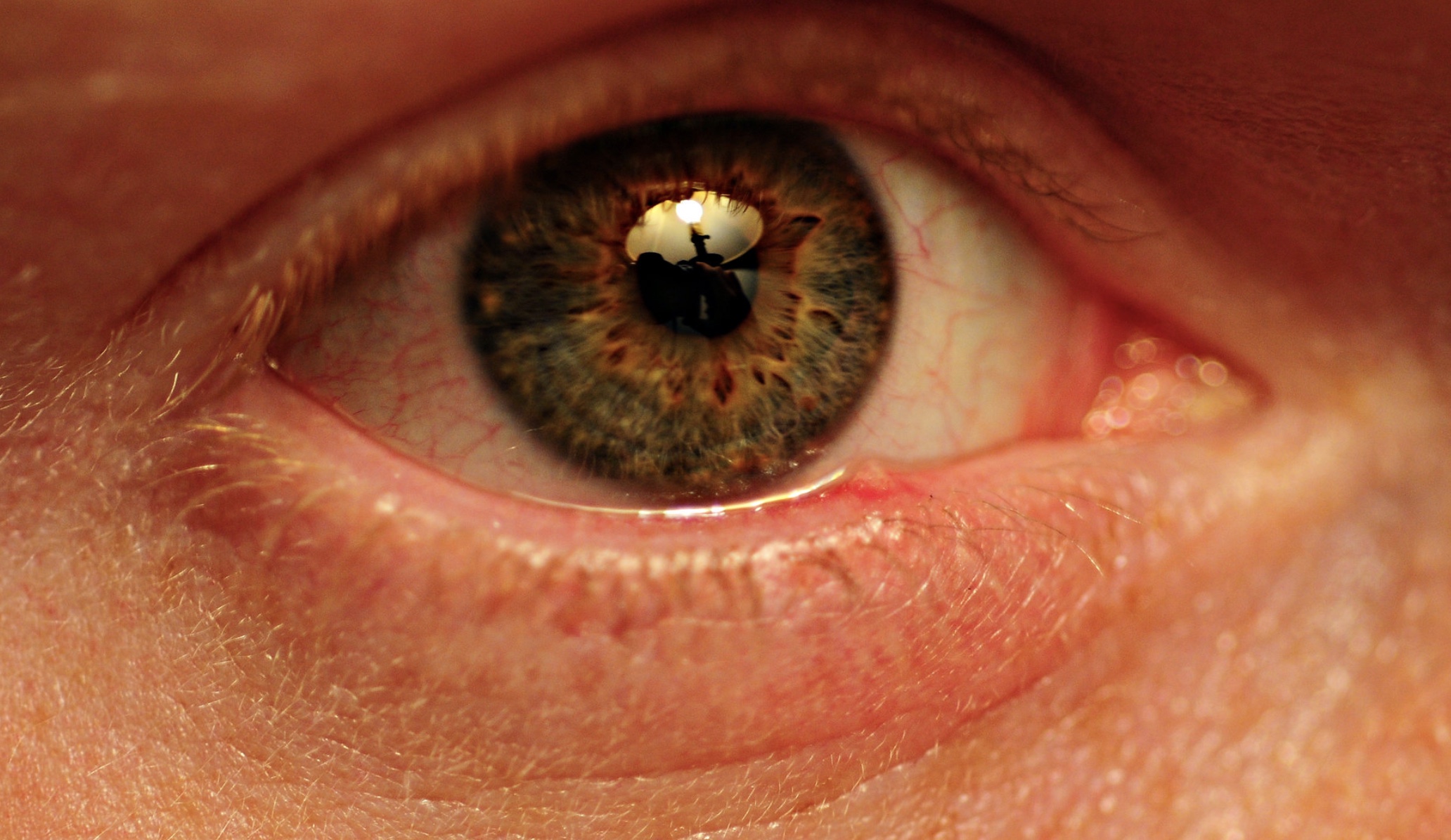 How do styes happen?