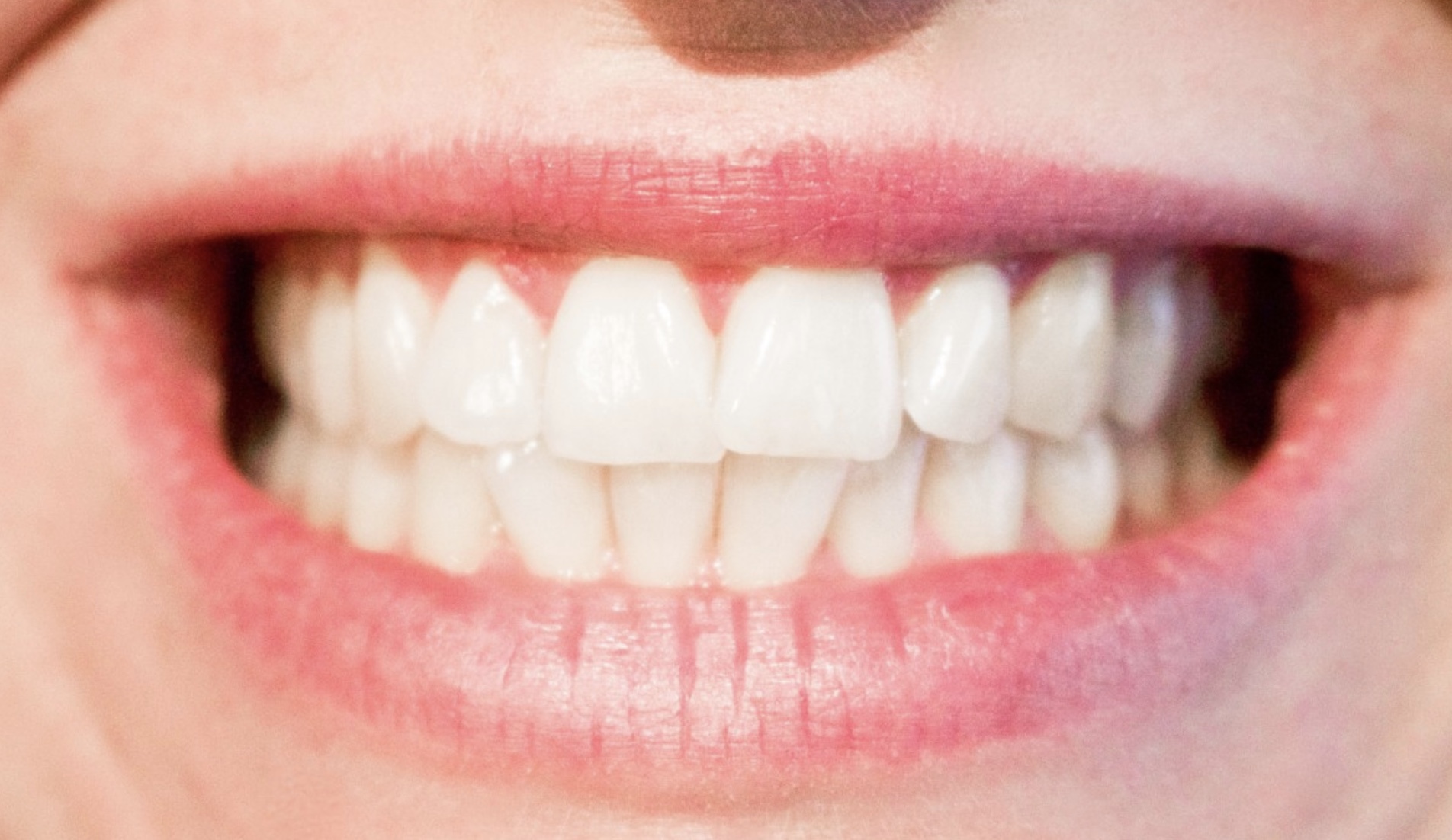 5 Easy Ways to Improve Your Mouth Health