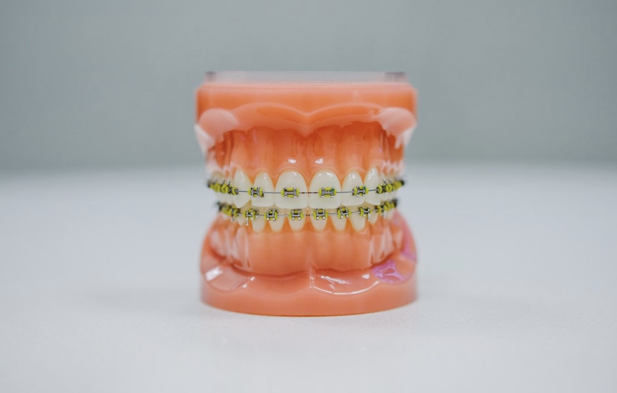 What to Expect When Adjusting to a New Dental Care Routine With Braces