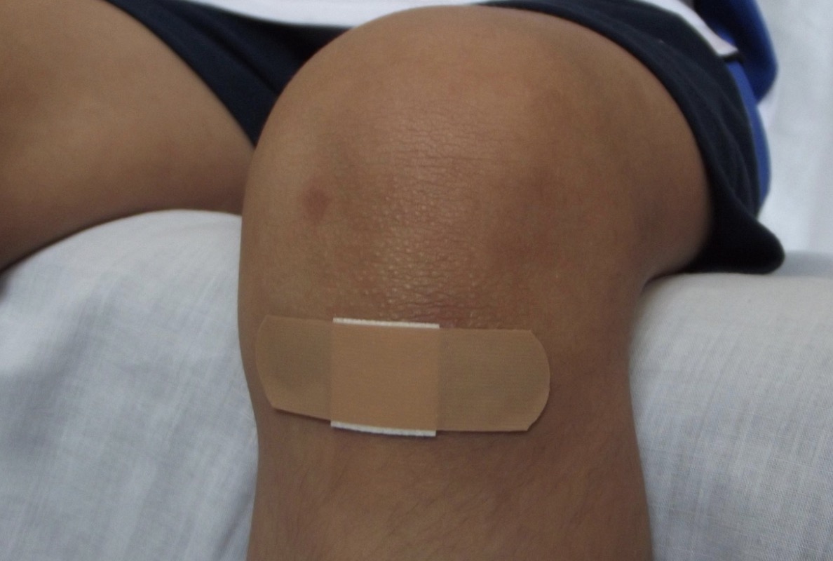 Injured? 6 Ways to Protect Your Health and Future